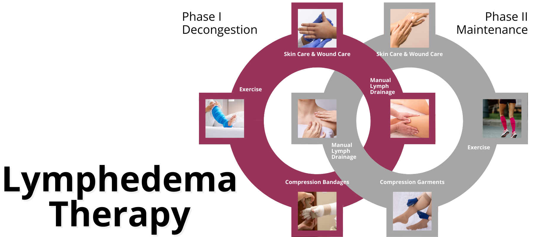 Woman practicing self-care techniques for lymphedema